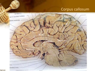 Genu Splenum 002 Surgical anatomy of the brain | PPTX