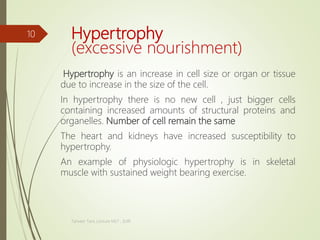 Hypertrophy
(excessive nourishment)
Hypertrophy is an increase in cell size or organ or tissue
due to increase in the size of the cell.
In hypertrophy there is no new cell , just bigger cells
containing increased amounts of structural proteins and
organelles. Number of cell remain the same
The heart and kidneys have increased susceptibility to
hypertrophy.
An example of physiologic hypertrophy is in skeletal
muscle with sustained weight bearing exercise.
Tanveer Tara ,Lecture MLT , SUIR
10
 