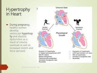 Hypertrophy
in Heart
 During pregnancy,
healthy women
develop
ventricular hypertrop
hy and diastolic
dysfunction as a
result of volume
overload as well as
increased stretch and
force demand.
.
Tanveer Tara ,Lecture MLT , SUIR
15
 