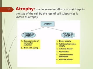 Tanveer Tara ,Lecture MLT , SUIR
16 Atrophy: is a decrease in cell size or shrinkage in
the size of the cell by the loss of cell substances is
known as atrophy
 