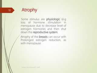Atrophy
Some stimulus are physiologic (e.g
loss of hormone stimulation in
menopause due to decrease level of
estrogen hormones and then shut
down the reproductive system.
Atrophy of the breasts can occur with
Prolonged estrogen reduction, as
with menopause.
Tanveer Tara ,Lecture MLT , SUIR
18
 