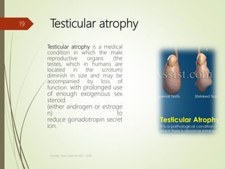 Testicular atrophy
Testicular atrophy is a medical
condition in which the male
reproductive organs (the
testes, which in humans are
located in the scrotum)
diminish in size and may be
accompanied by loss of
function. with prolonged use
of enough exogenous sex
steroid
(either androgen or estroge
n) to
reduce gonadotropin secret
ion.
Tanveer Tara ,Lecture MLT , SUIR
19
 