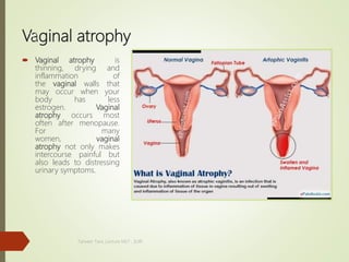 Vaginal atrophy
 Vaginal atrophy is
thinning, drying and
inflammation of
the vaginal walls that
may occur when your
body has less
estrogen. Vaginal
atrophy occurs most
often after menopause.
For many
women, vaginal
atrophy not only makes
intercourse painful but
also leads to distressing
urinary symptoms.
Tanveer Tara ,Lecture MLT , SUIR
20
 