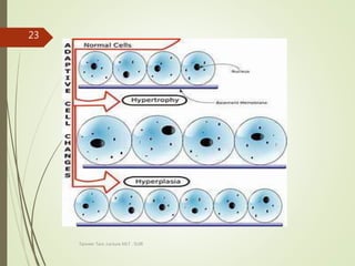 Tanveer Tara ,Lecture MLT , SUIR
23
 