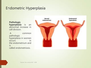 Endometric Hyperplasia
Pathologic
hyperplasia is an
abnormal increase in
cell division.
A common
pathologic
hyperplasia in women
occurs in
the endometrium and
is
called endometriosis.
Tanveer Tara ,Lecture MLT , SUIR
25
 