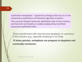 These transformed cells may become dysplastic or cancerous
if the stimulus (e.g., cigarette smoking) is not Stop.
If stress persists, metaplasia can progress to dysplasia and
eventually carcinoma;
Tanveer Tara ,Lecture MLT , SUIR
33
 