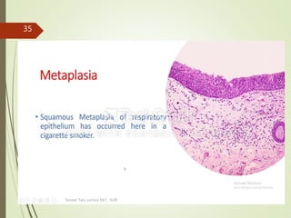Tanveer Tara ,Lecture MLT , SUIR
35
 