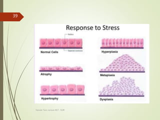 Tanveer Tara ,Lecture MLT , SUIR
39
 