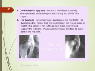 Tanveer Tara ,Lecture MLT , SUIR
41
 