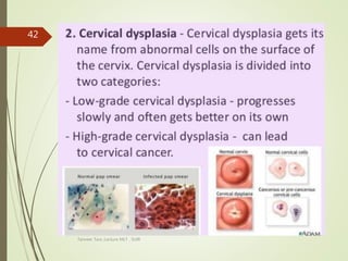 Tanveer Tara ,Lecture MLT , SUIR
42
 