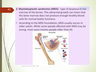 Tanveer Tara ,Lecture MLT , SUIR
43
 