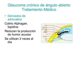 Glaucoma crónico de ángulo abierto
         Tratamiento Médico
• Derivados de
  adrenalina
Colirio Alphagan,
  Iopidine
Reducen la producción
  de humor acuoso
Se utilizan 2 veces al
  día
 