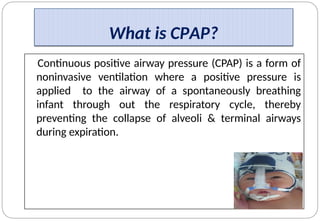 pumani bubble cpap in Malawis . RDS CARE | PPT