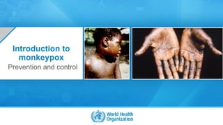 OpenWHO.org 0
©WHO2020
Introduction to
monkeypox
Prevention and control
 