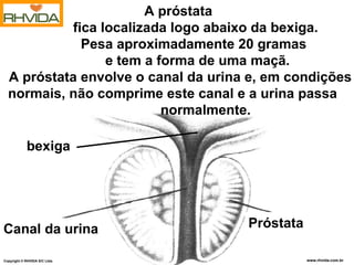 A próstata
            fica localizada logo abaixo da bexiga.
              Pesa aproximadamente 20 gramas
                  e tem a forma de uma maçã.
  A próstata envolve o canal da urina e, em condições
  normais, não comprime este canal e a urina passa
                           normalmente.

            bexiga




Canal da urina                       Próstata

Copyright © RHVIDA S/C Ltda.                www.rhvida.com.br
                                              www.rhvida.com.br
 