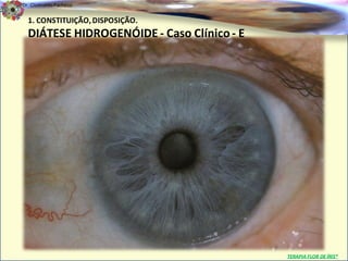 Dr. Clodoaldo Pacheco

  1. CONSTITUIÇÃO, DISPOSIÇÃO.                                      .

  DIÁTESE HIDROGENÓIDE - Caso Clínico - E




                                            TERAPIA FLOR DE ÍRIS®
 