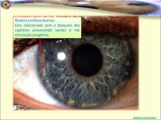 Dr. Clodoaldo Pacheco                     6a

                                                                       .


    Rosário Linfático branco
    Esta relacionado com o bloqueio dos
    capilares provocando varizes e má
    circulação congênita.




                                               TERAPIA FLOR DE ÍRIS®
 