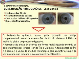 Dr. Clodoaldo Pacheco

                                                                                     .
 1. CONSTITUIÇÃO, DISPOSIÇÃO.
 CONSTITUIÇÃO HIDROGENÓIDE - Caso Clínico
  Íris: Esquerda e Direita
  Paciente: Homem de 65 anos
  Constituição: Linfática Hidrogenoide
  Disposição: Neurogenética




O tratamento quimico passou pela remoção da bexiga
complementado com tratamento flor de íris do sistema linfático e
melhoria global do processo digestivo.
A recuperação deste Sr. ocorreu de forma rapida quando se uniu os
dois tratamentos: Terapia Flor de Íris e Quimica. A terapia flor de Íris
é a soma e a união do melhor tratamento para garantir a saúde do
ser humano que procura o microseometista oftámilco.
                                                             TERAPIA FLOR DE ÍRIS®
 