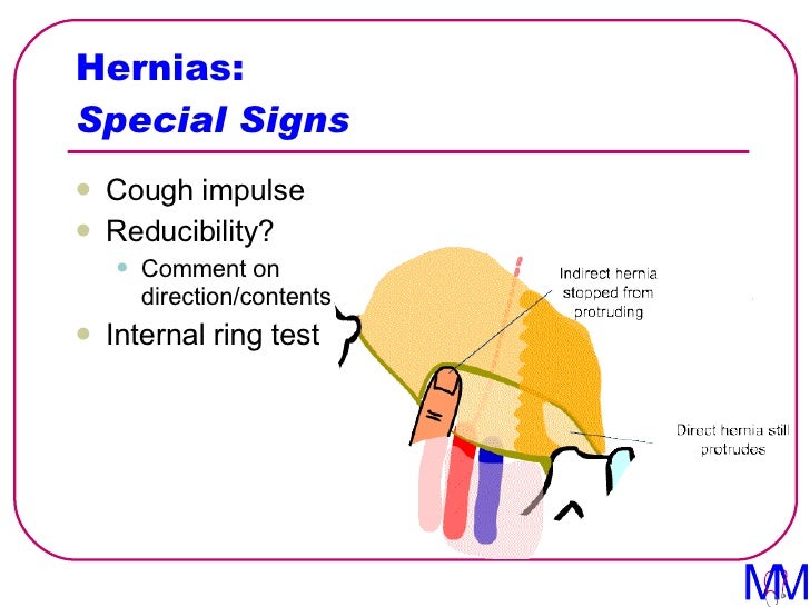 004 Hernias Introduction to Clinical Surgery Lectures