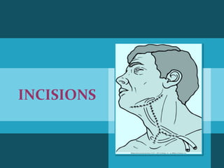 Neck Dissection Incision Apron Surgical anatomy and approaches to neck | PPTX