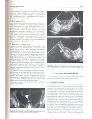 004 patologia maligna de endometrio 