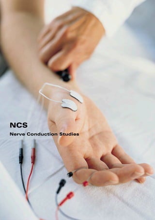 NCS
Nerve Conduction Studies
 