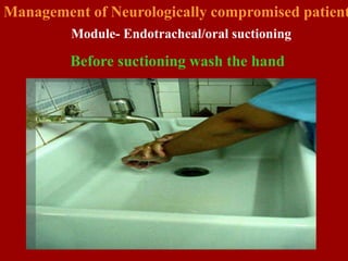 Hand Suction Method 005 Suctioning.ppt