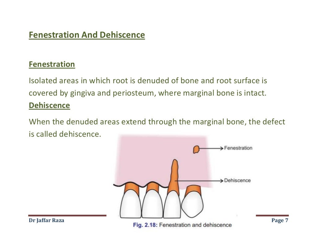 006.alveolar bone