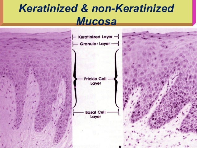 Oral Mucous Membrane Histology Ppt – VILSCI