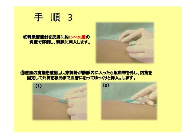 006徳洲会 点滴法