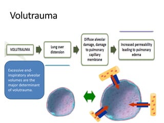 Volutrauma
Excessive end-
inspiratory alveolar
volumes are the
major determinant
of volutrauma.
 