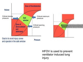 HFOV is used to prevent
ventilator induced lung
injury
Critical opening
pressure
Critical maximum
pressure
Critical closing
pressure
 