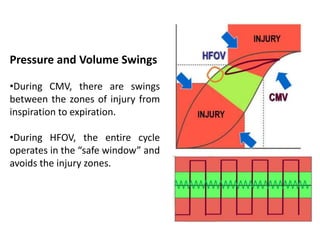 Pressure and Volume Swings
•During CMV, there are swings
between the zones of injury from
inspiration to expiration.
•During HFOV, the entire cycle
operates in the “safe window” and
avoids the injury zones.
 