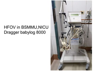 HFOV in BSMMU,NICU
Dragger babylog 8000
 