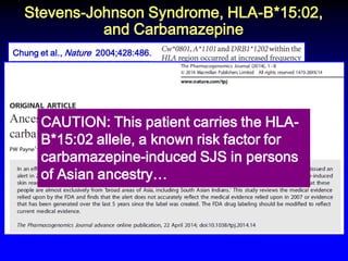 Stevens-Johnson Syndrome, HLA-B*15:02, and Carbamazepine 
Chung et al., Nature 2004;428:486. 
N Engl J Med. 2011;364:1134-43. 
Clin Pharm Therap 2012;92:757-65. 
“Clinicians must determine if a patient has ancestry across broad areas of Asia. This requires clinicians to know what ‘Asian ancestry’ means and use a consistent, reliable method to figure out which 
patients have this ancestry.” 
CAUTION: This patient carries the HLA- B*15:02 allele, a known risk factor for carbamazepine-induced SJS in persons of Asian ancestry… 