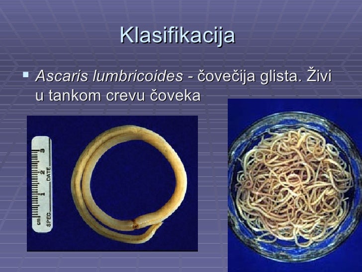 Valjkasti crvi