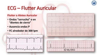 007 Electrocardiograma Segunda Parte PPTX 007 Electrocardiograma Segunda Parte PPTX