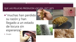 QUE LAS PELUCAS PRODUCEN LOCURA. OCT 1871
“muchas han perdido
su razón y han
llegado a un estado
de locura sin
esperanza”
 Douglas
 