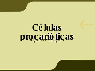 Células procarióticas Algumas imagens 