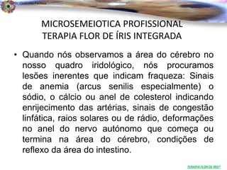 Dr. Clodoaldo Pacheco

                                                                          .

                 MICROSEMEIOTICA PROFISSIONAL
                 TERAPIA FLOR DE ÍRIS INTEGRADA
• Quando nós observamos a área do cérebro no
  nosso quadro iridológico, nós procuramos
  lesões inerentes que indicam fraqueza: Sinais
  de anemia (arcus senilis especialmente) o
  sódio, o cálcio ou anel de colesterol indicando
  enrijecimento das artérias, sinais de congestão
  linfática, raios solares ou de rádio, deformações
  no anel do nervo autónomo que começa ou
  termina na área do cérebro, condições de
  reflexo da área do intestino.
                                                  TERAPIA FLOR DE ÍRIS®
 