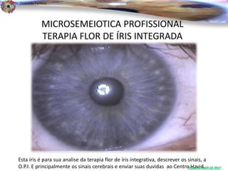 Dr. Clodoaldo Pacheco

                                                                                                     .

                 MICROSEMEIOTICA PROFISSIONAL
                 TERAPIA FLOR DE ÍRIS INTEGRADA




  Esta íris é para sua analise da terapia flor de íris integrativa, descrever os sinais, a
  O.P.I. E principalmente os sinais cerebrais e enviar suas duvidas ao CentroTERAPIA FLOR DE ÍRIS®
                                                                                  Havid.
 