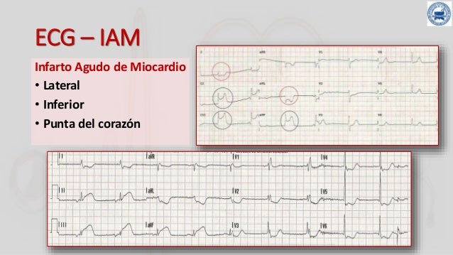 008 electrocardiograma tercera parte