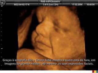 Ria slides
Graças à ecografia 4D, o futuro bebé mostra a quem está de fora, em
 imagens de grande nitidez, até mesmo as suas expressões faciais.
 