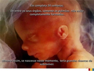 Ele completa 24 semanas.
     De entre os seus órgãos, somente os pulmões não estão
                    completamente formados.




                                                             Ria slides
Mesmo assim, se nascesse neste momento, teria grandes chances de
                           sobreviver.
 