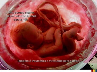 Sim, porque o parto
não é doloroso apenas
     para a mãe.




       Também é traumático e stressante para o bebé.
 