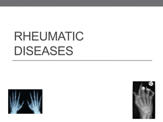 RHEUMATIC
DISEASES
 