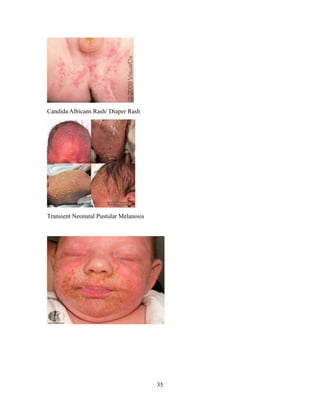 important topics of skin, orthopedics, Eye, ENT, Infectious diseasese ...