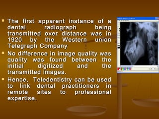  The first apparent instance of aThe first apparent instance of a
dental radiograph beingdental radiograph being
transmitted over distance was intransmitted over distance was in
1920 by the Western union1920 by the Western union
Telegraph CompanyTelegraph Company
 No difference in image quality wasNo difference in image quality was
quality was found between thequality was found between the
initial digitized and theinitial digitized and the
transmitted images.transmitted images.
 Hence, Teledentistry can be usedHence, Teledentistry can be used
to link dental practitioners into link dental practitioners in
remote sites to professionalremote sites to professional
expertise.expertise.
 