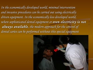 In the economically developed world, minimal interventionIn the economically developed world, minimal intervention
and invasive procedures can be carried out using electricallyand invasive procedures can be carried out using electrically
driven equipment. In the economically less developed world,driven equipment. In the economically less developed world,
where sophisticated dental equipment orwhere sophisticated dental equipment or even electricity is noteven electricity is not
always availablealways available, the modern approach for the control of, the modern approach for the control of
dental caries can be performed without this special equipmentdental caries can be performed without this special equipment
 
