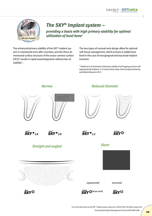 009912GB_SKYonics Implant Prosthetics.pdf